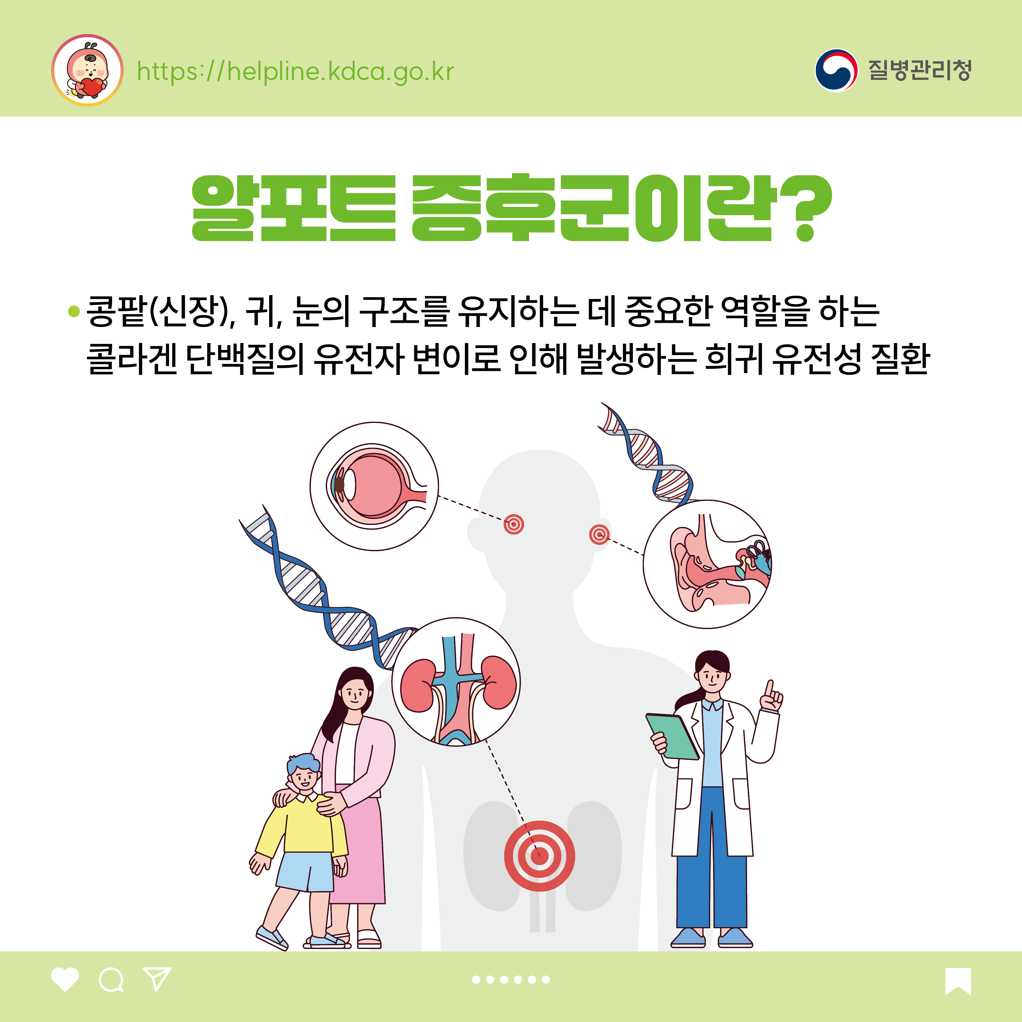 알포트 증후군이란? - 콩팥(신장), 귀, 눈의 구조를 유지하는 데 중요한 역할을 하는 콜라겐 단백질의 유전자 변이로 인해 발생하는 희귀 유전성 질환